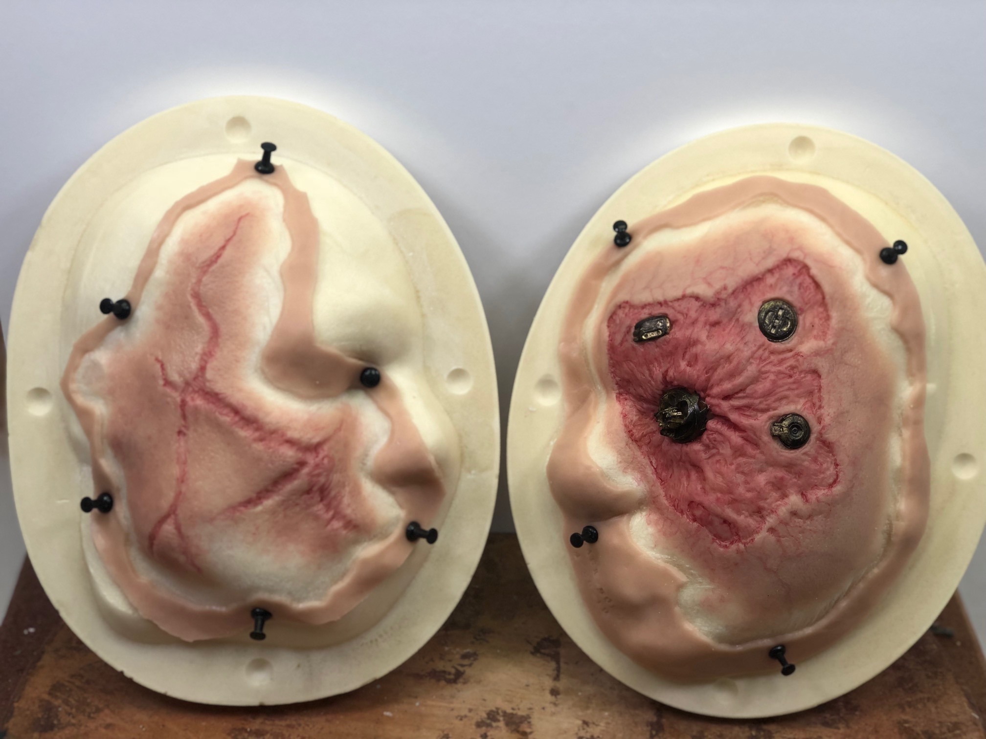 Pre-painted silicone appliances and the completed xB makeup on amputee actor Zachary James Rukavina.&nbsp;&nbsp;Image courtesy James MacKinnon/CBS All Access.