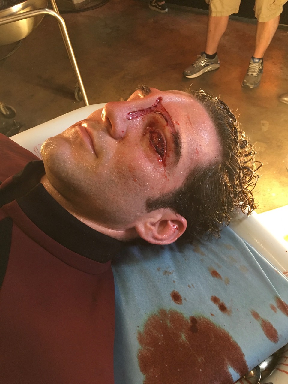 Actor Casey King as Icheb in prosthetics for his gory death scene in Star Trek: Picard.&nbsp; Image courtesy&nbsp;James MacKinnon/CBS All Access.