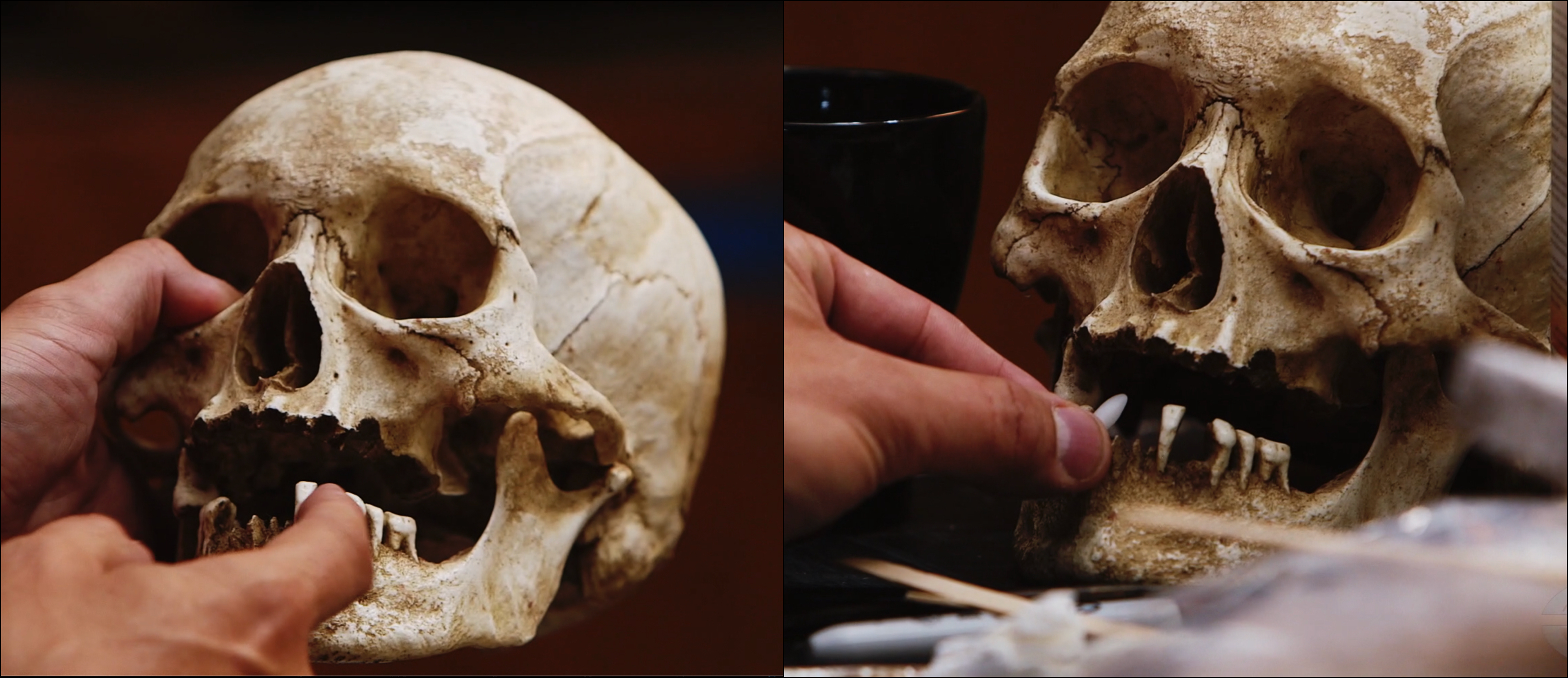 A cast replica of a human skull features several teeth protruding from the lower jaw.
