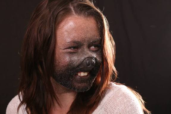 Finished facial appliance, including flocking.