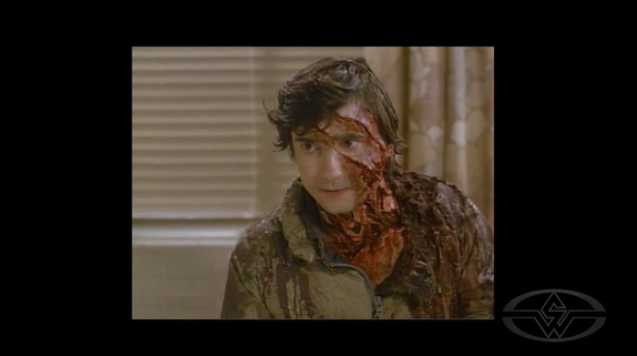 Griffin Dunne is beaten out of the scene by his own "Nurney" in An American Werewolf in London.